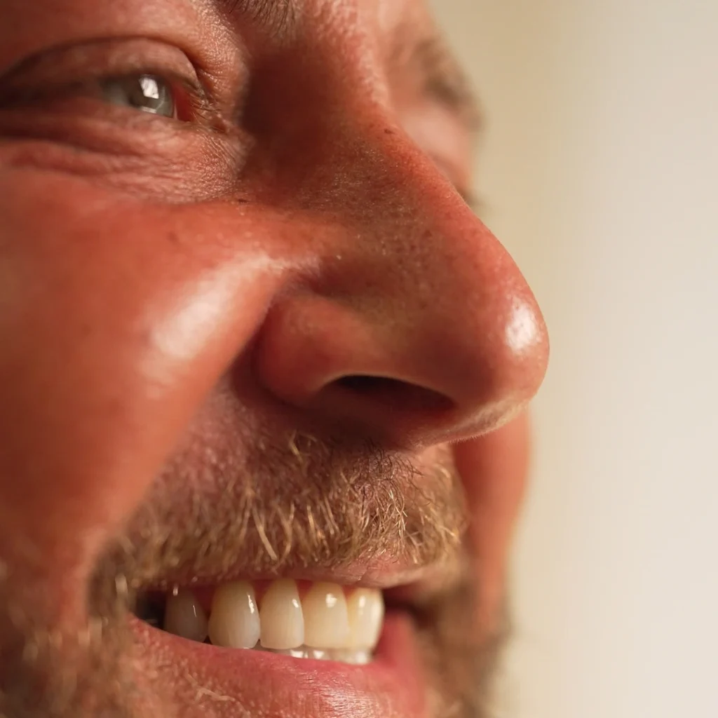 Adult Orthodontics in Winchester