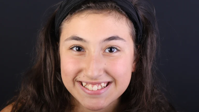 Aline Specialists | Orthodontists in Winchester