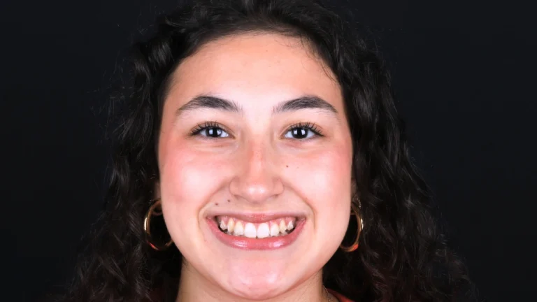 Aline Specialists | Orthodontists in Winchester