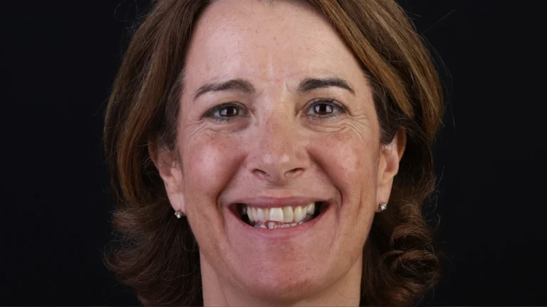 Aline Specialists | Orthodontists in Winchester