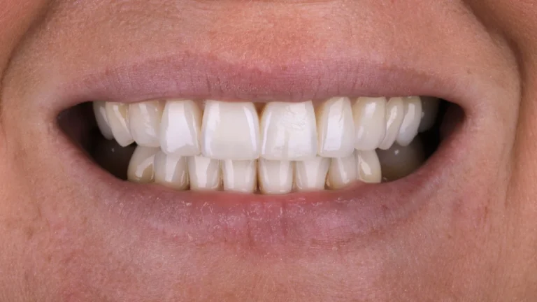 Aline Specialists | Orthodontists in Winchester