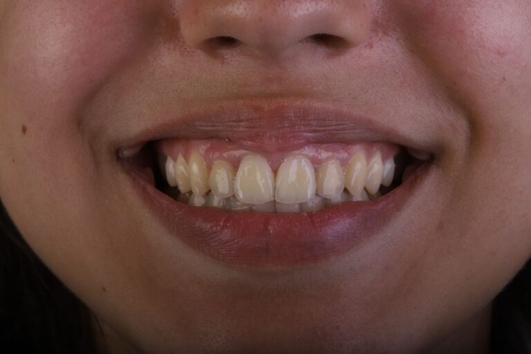 Case 1_compressed