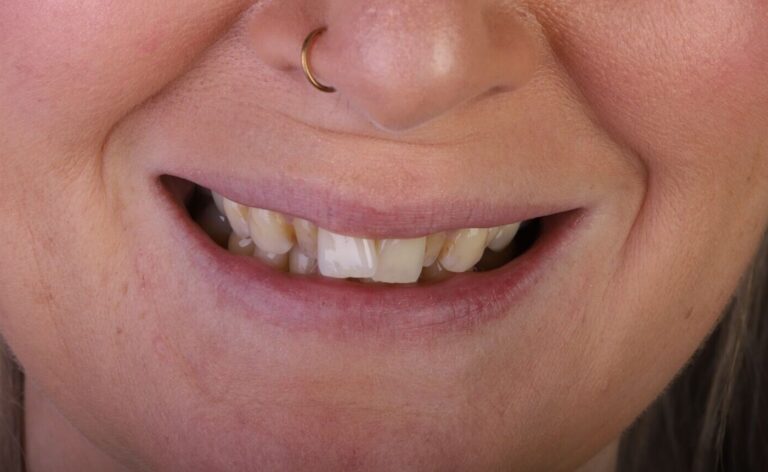 Case 5 before_compressed