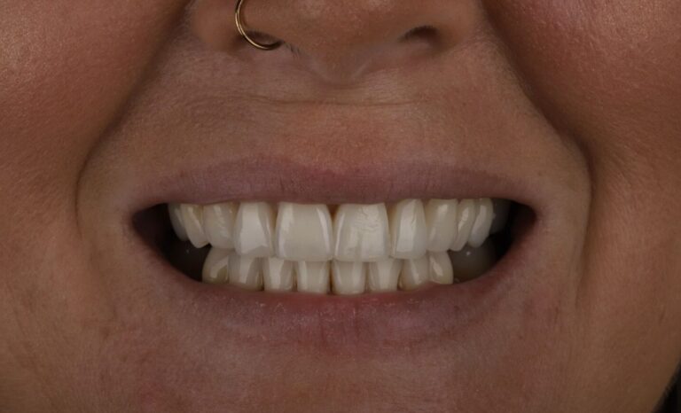 Case 5_compressed