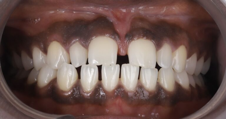 Case 7 before_compressed