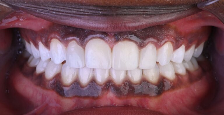 Case 7_compressed