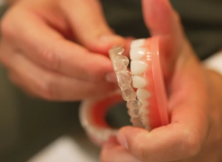 How Do Clear Aligners Work