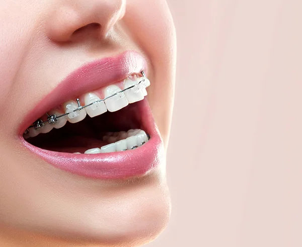 invisalign thumb2