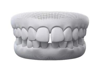 teeth thumb02